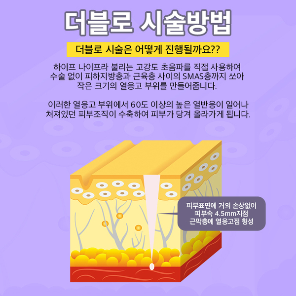 더블로골드로 피부탄력은 UP! 피부나이는 DOWN! 관련 이미지 2