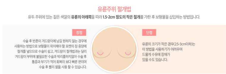 가슴성형 아름다운 라인을 위해 꼼꼼히 알아보자! 관련 이미지 6