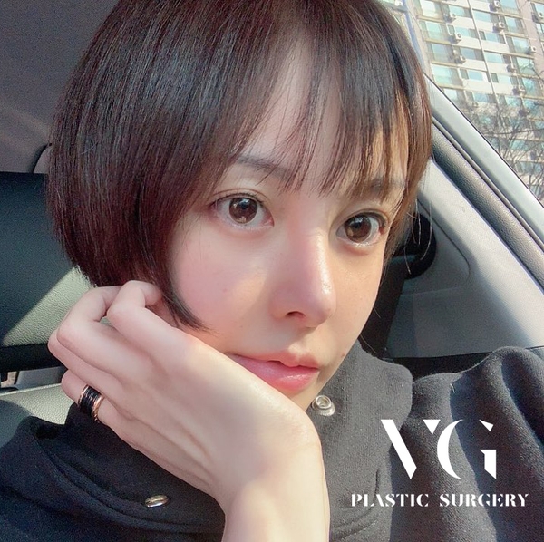 광대축소술 매끄러운 라인을 원한다면? 관련 이미지 1