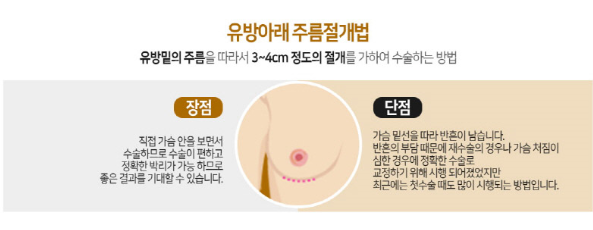 부드러운 촉감에 자연스러운 가슴성형을 찾는다면 베리굿성형외과로! 관련 이미지 5