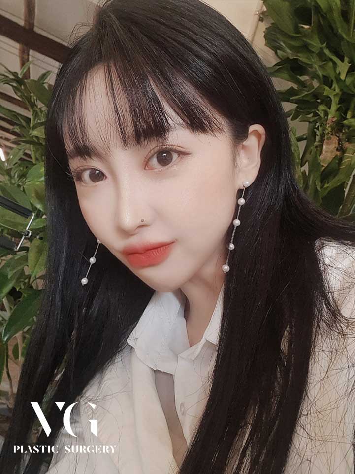 마지막 코재수술 성공적으로 하는법 후기로 확인하세요! 관련 이미지 1