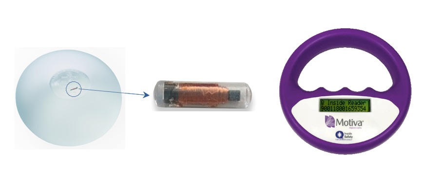 모티바가슴성형 알아야할 몇가지! 관련 이미지 3