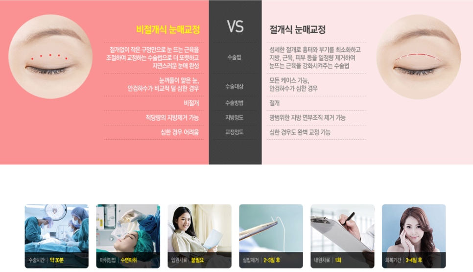 비절개눈매교정 또렷하고 선명한 인상으로! 관련 이미지 3