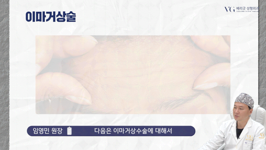 강남중년눈성형 잘하는곳 , 상안검 하안검 눈썹하거상술종류 진행방법 궁금하다면 관련 이미지 38