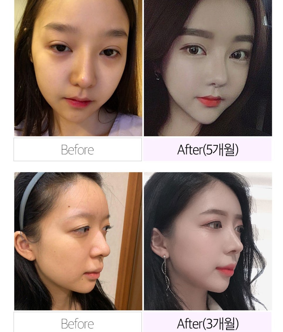 마지막 코재수술은 베리굿에서~ 관련 이미지 8