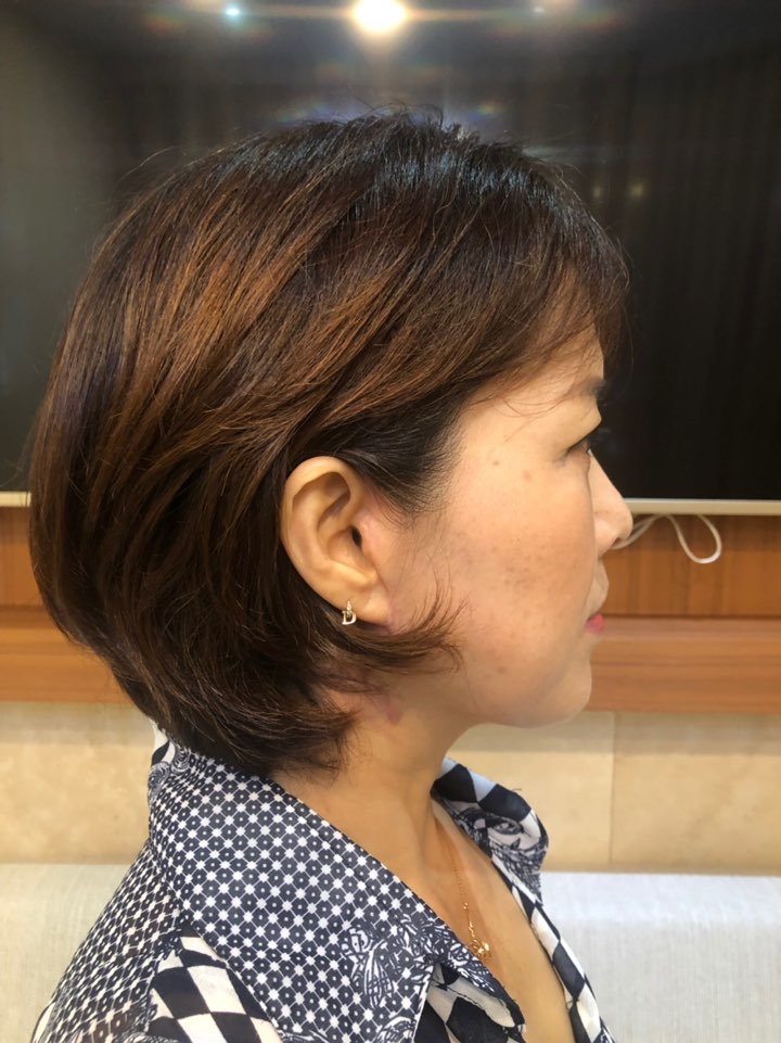 베리굿 안면거상으로 세월의 흔적, 피부처짐과 깊은 주름을 한번에 개선하자! 관련 이미지 6