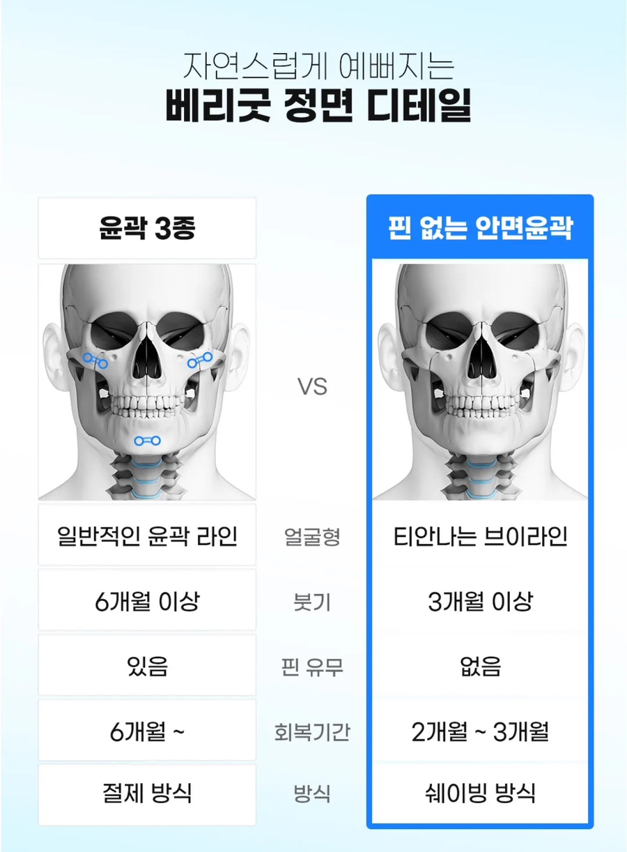 회복기간 빠르고 붓기적은 안면윤곽 원한다면 , 연예인 핀없는 안면윤곽 관련 이미지 6