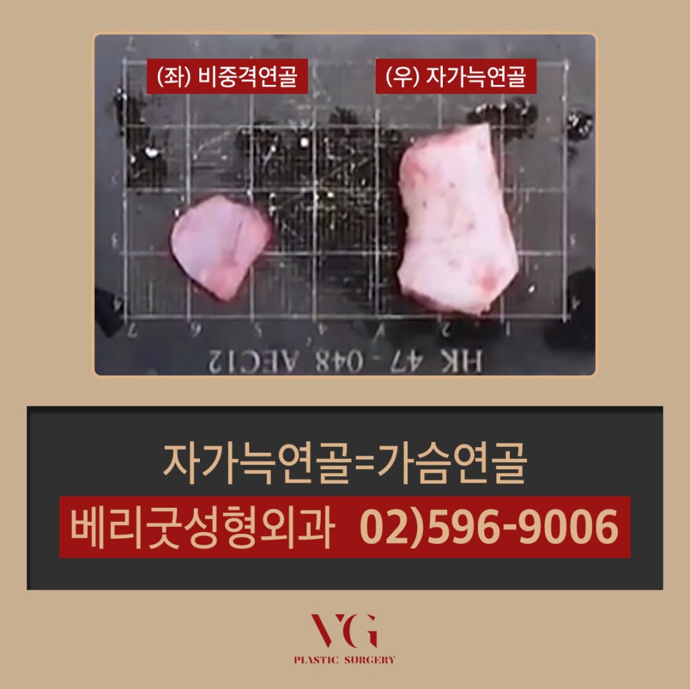 코재수술전후 확실하게 확인하고 성공적으로 관련 이미지 6