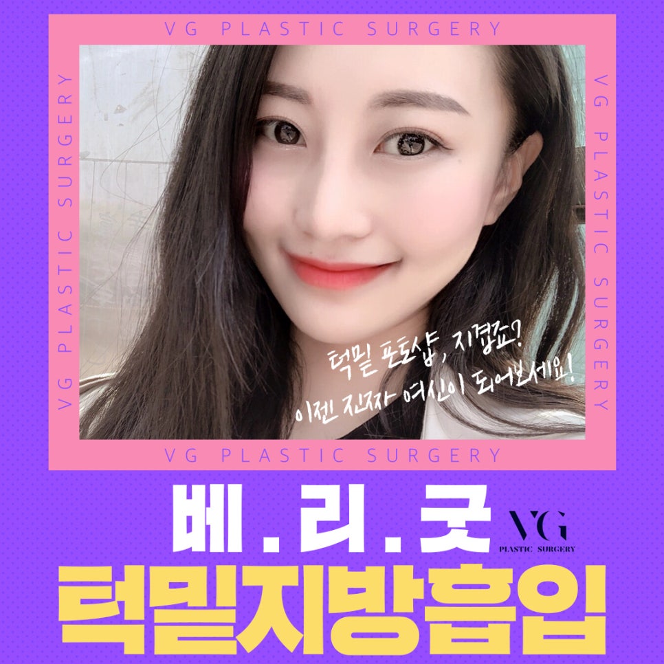 얼굴지방흡입으로 갸름한 v라인으로! 관련 이미지 2