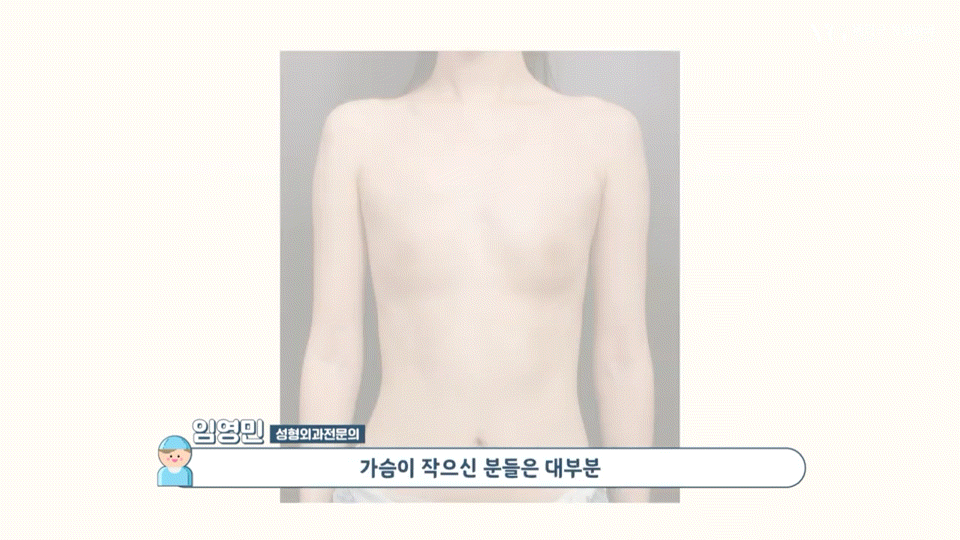 강남역가슴성형 절개법 절개부위 , 체형별 적합한 다양한 절개방법 장단점 총정리 관련 이미지 4