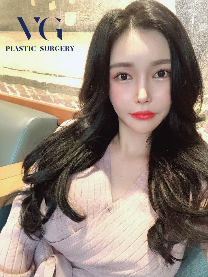 처진살로 울퉁불퉁한 얼굴라인 실리프팅으로 매끈하고 탱탱하게! 관련 이미지 4