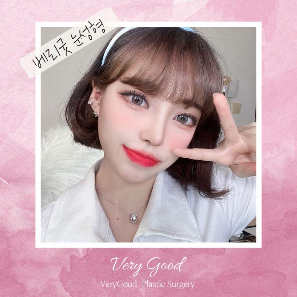 베리굿 성형외과 맞춤별 쌍수👀❤ 관련 이미지 1