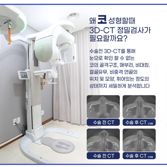 코재수술원인 부터 강남코재수술잘하는병원 , 코재수술실제후기 궁금하다면 관련 이미지 3