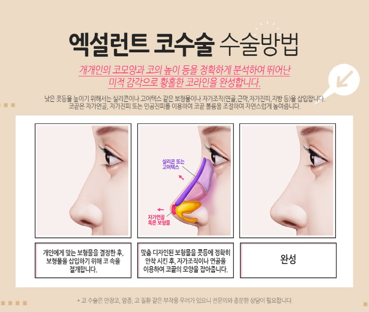 코성형 하나로 세련된 이미지완성! 관련 이미지 4