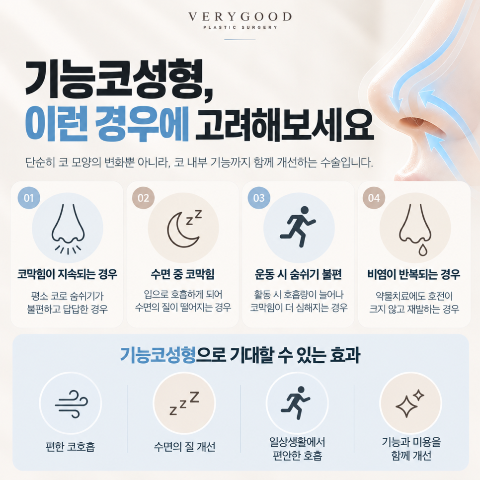 코로 숨을 들이마실 때 답답하다면? 비밸브 협착과 기능코성형 관련 이미지 4