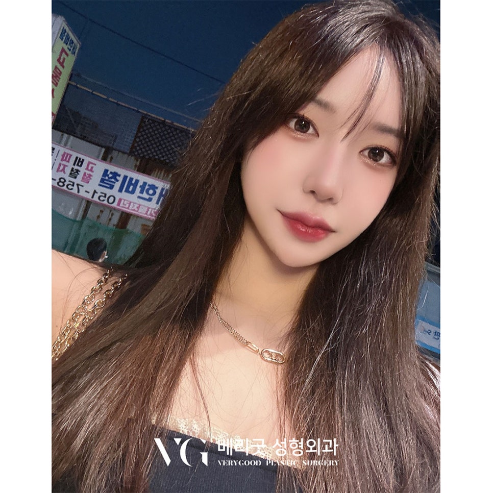 [베리굿성형외과] 강남언니 고객평가 우수병원 7,8,9월 연속 등극 ! 관련 이미지 6