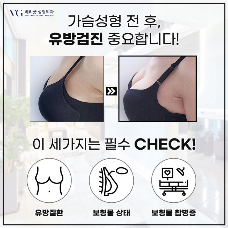 강남역가슴성형 , 가슴수술보형물 교체시기 따로 있나요? 관련 이미지 2