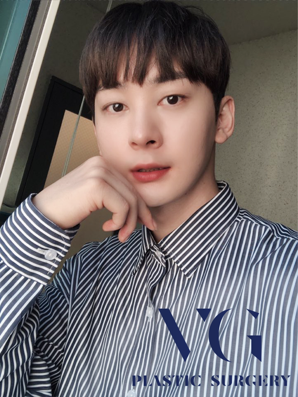 사각턱축소 내게 맞는 라인으로 관련 이미지 5