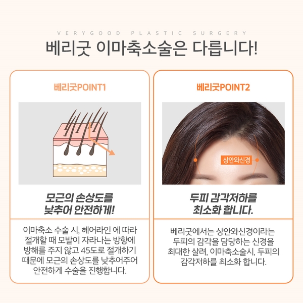 이마축소로 이상적인 이마높이로! 관련 이미지 4