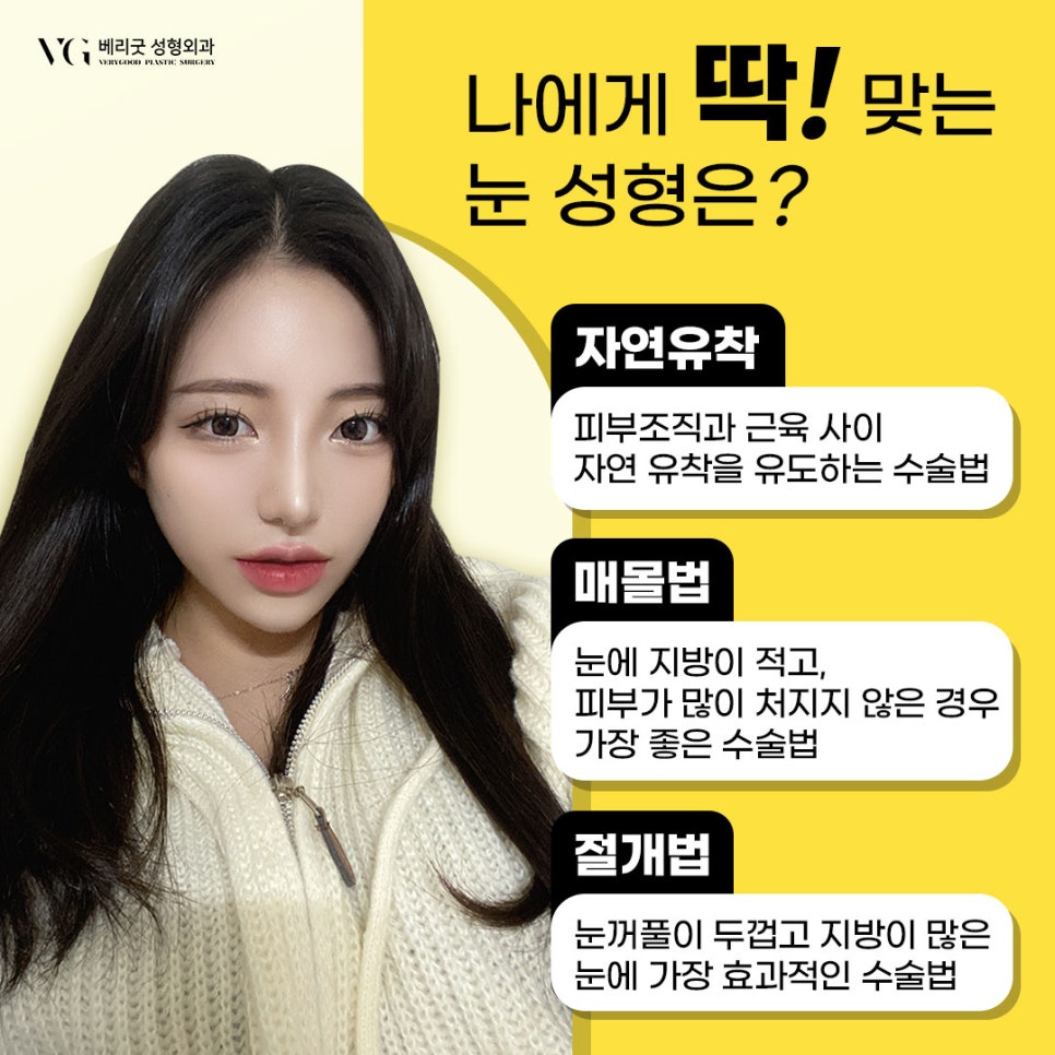 자연유착 쌍커풀수술잘하는곳 , 매몰 절개 차이점 그리고 쌍커풀비용 수술과정 궁금하다면 관련 이미지 5