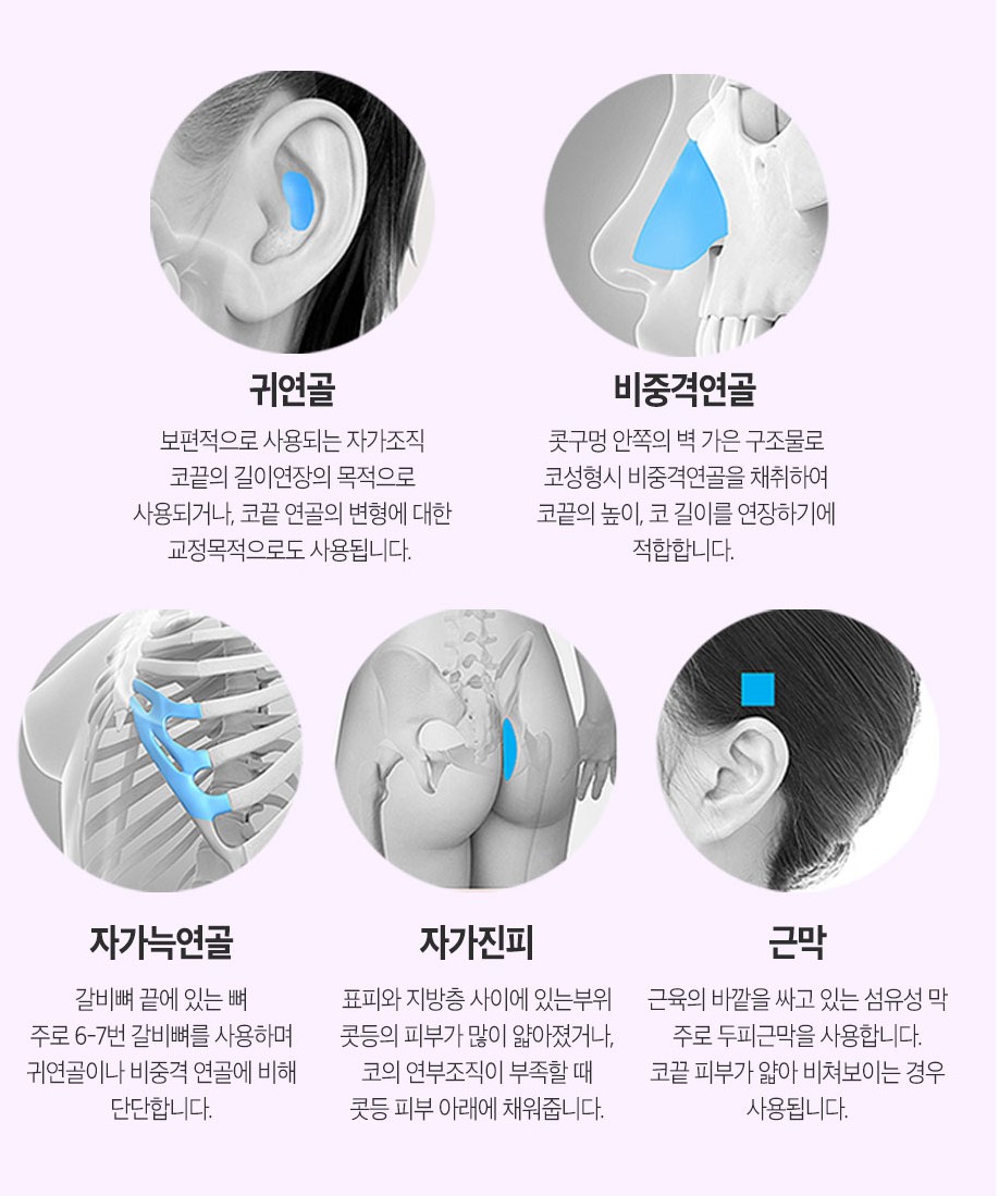 마지막 코재수술은 베리굿에서~ 관련 이미지 3