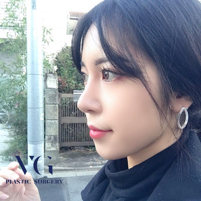 자가 늑연골 코재수술로 완벽해지자! 관련 이미지 1