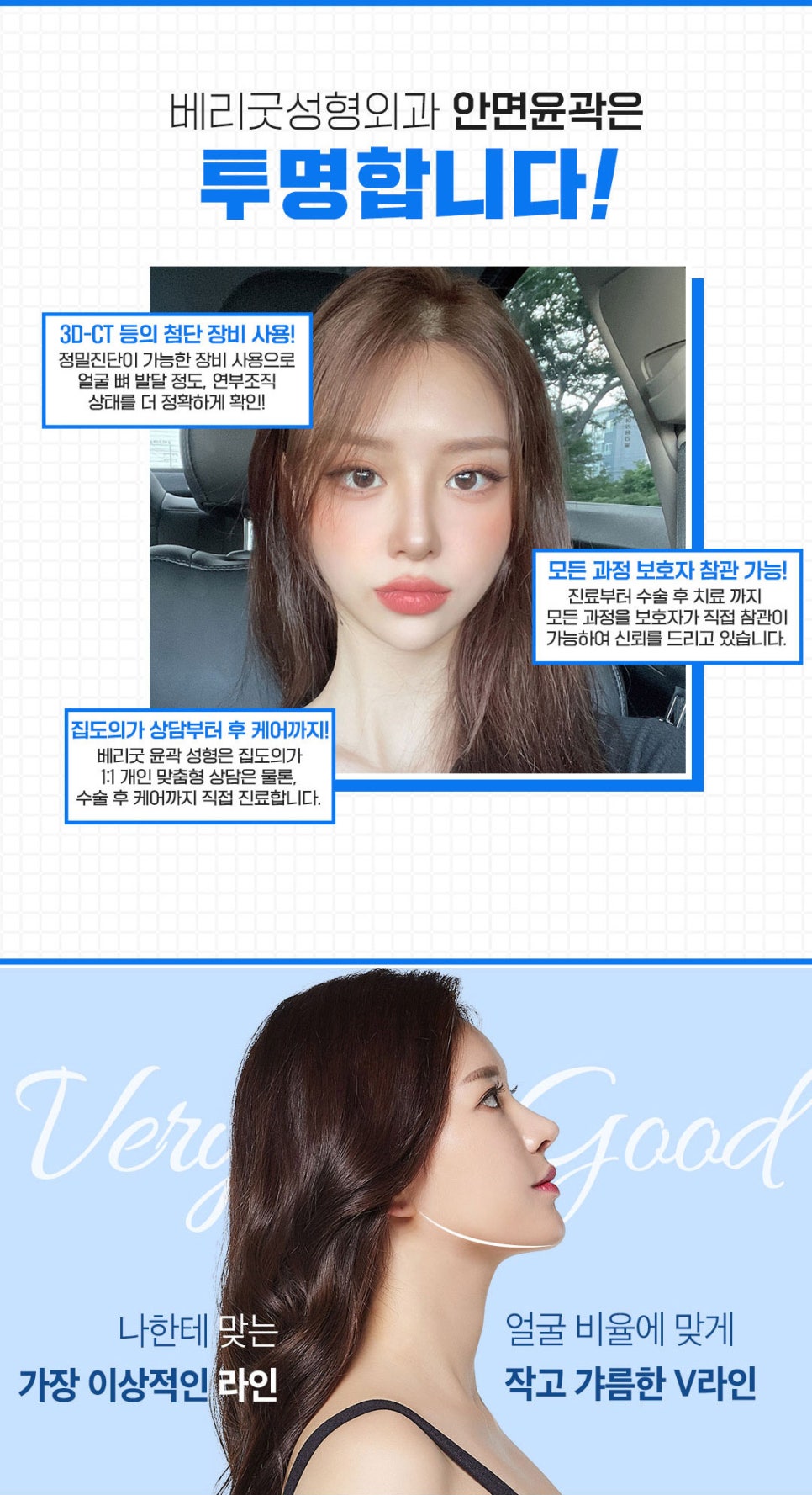 강남역광대축소 베리굿성형외과💜 관련 이미지 3