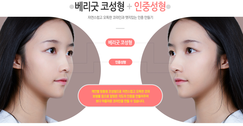 교정 없이! 발치 없이! 코성형으로 돌출입교정하자 ❤베리굿성형외과❤ 관련 이미지 4