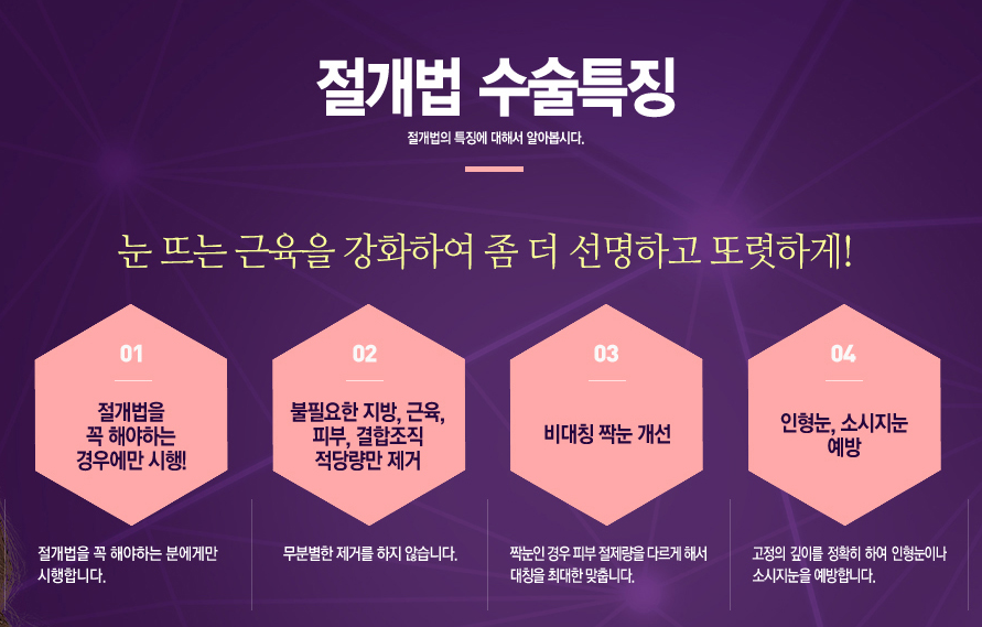 절개 쌍커풀 쌍수👀❣ 잘하는곳 베리굿성형외과❤ 관련 이미지 5