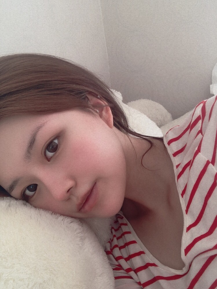 자가늑연골 코재수술 어디까지 알고있니? (코성형 1탄) 관련 이미지 1