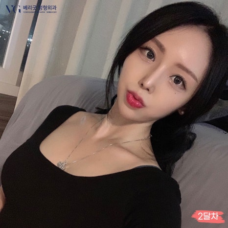 베리굿성형외과 기증늑연골 짧은코교정💖 관련 이미지 5