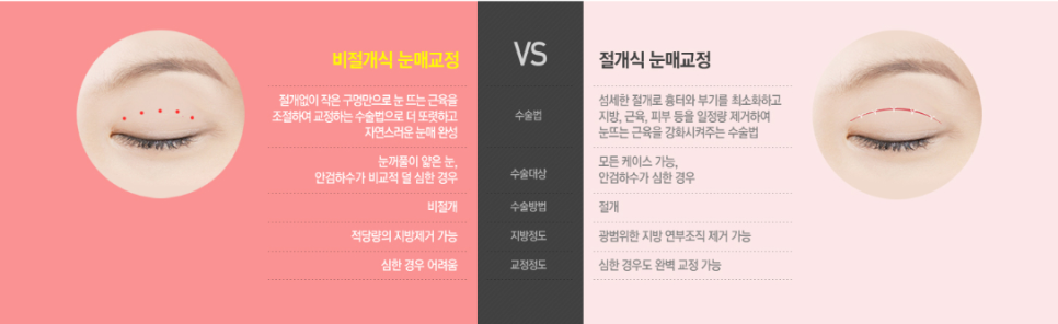 잘생김이 10배가 되는 베리굿 남자 눈매교정 관련 이미지 2