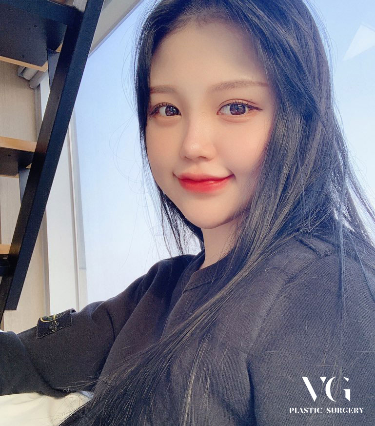 턱밑 두터운 이중턱! 깔끔하게 제거하는법! 관련 이미지 2