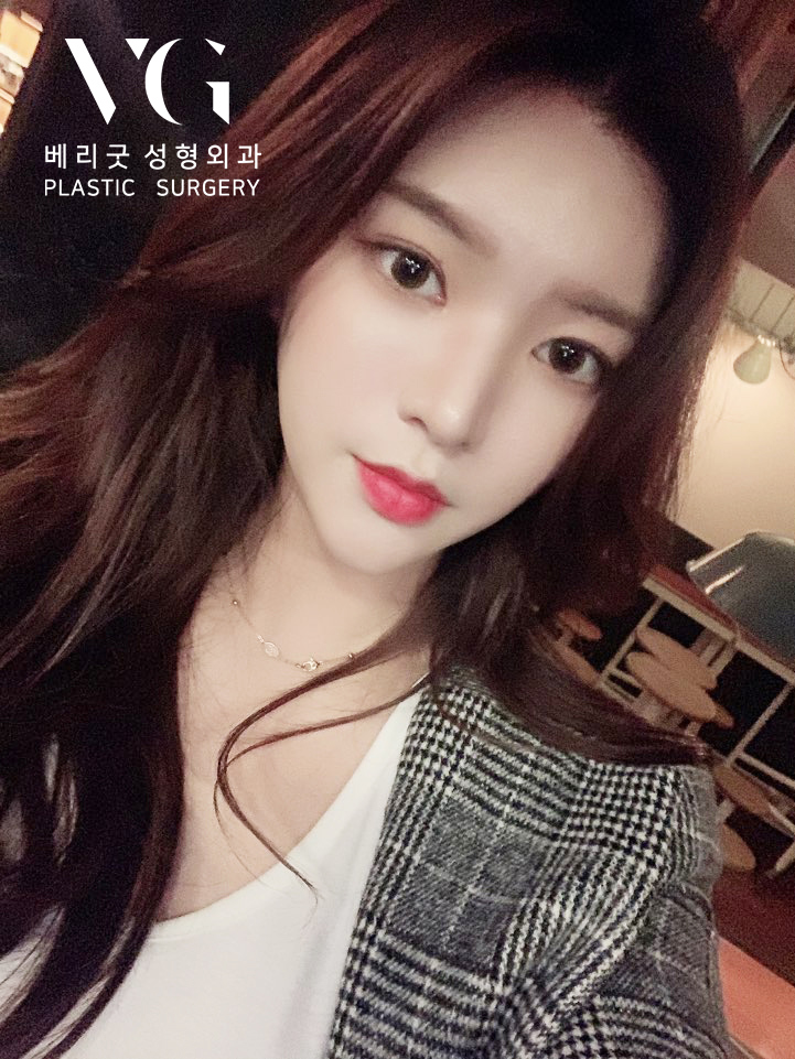 코성형 하나로 세련된 이미지로 관련 이미지 1