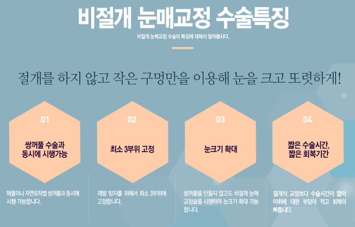 비절개눈매교정 또렷하고 선명한 인상으로! 관련 이미지 5