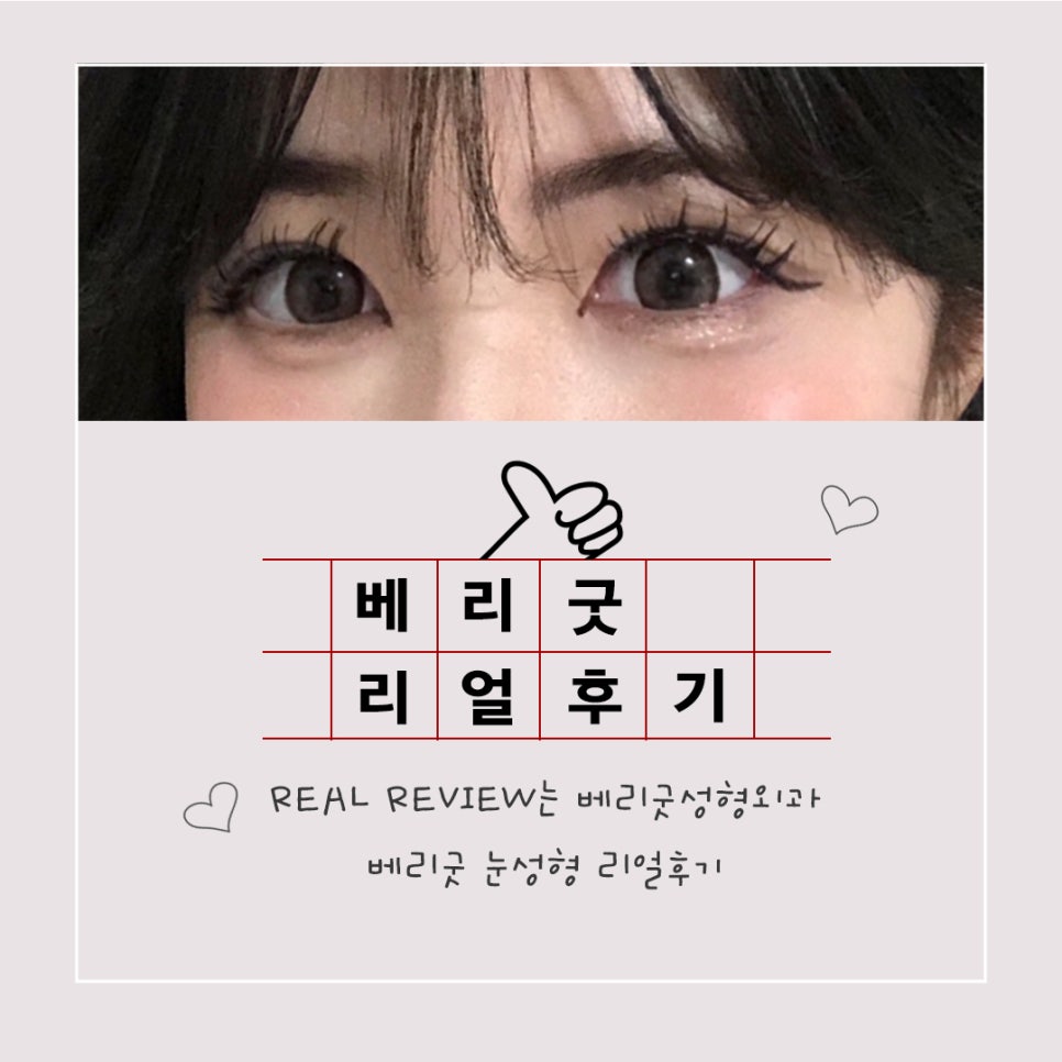 마지막 눈재수술-실패없는 선택 관련 이미지 3