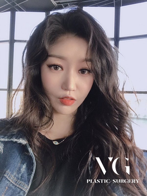 더블로리프팅 처진피부를 탱탱하게! 관련 이미지 1