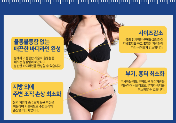 부유방, 팔 지방흡입 베리굿성형외과에서 모델같은 몸매! 관련 이미지 4