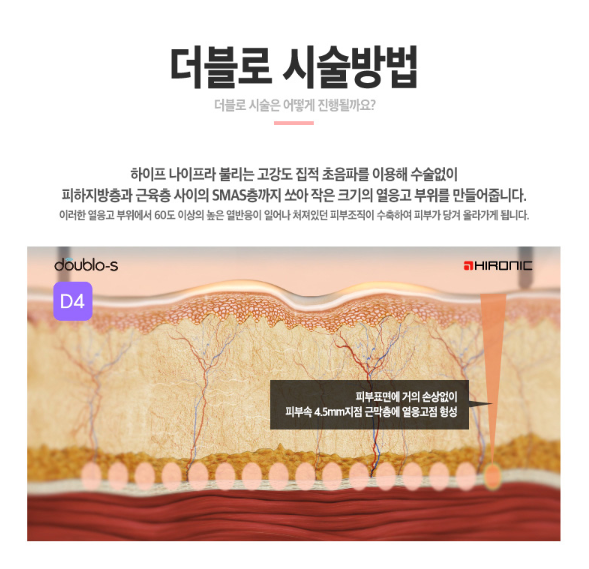 더블로골드로 피부탄력은 UP! 피부나이는 DOWN! 관련 이미지 5