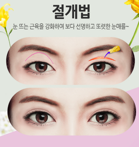 강남쌍꺼풀 수술 잘하는곳 실패없이 고르자 관련 이미지 7