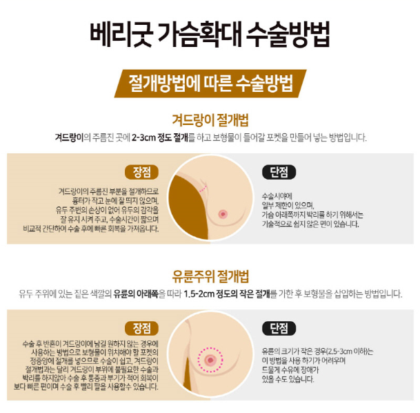 부드러운 촉감에 자연스러운 가슴성형을 찾는다면 베리굿성형외과로! 관련 이미지 4