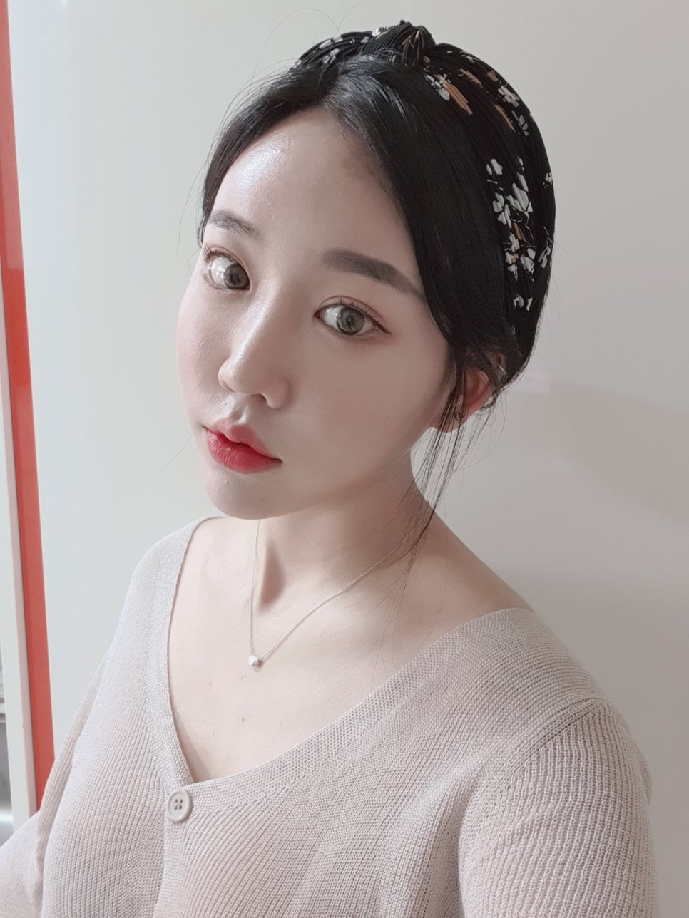 내시경이마리프팅으로 시원하게! 관련 이미지 1