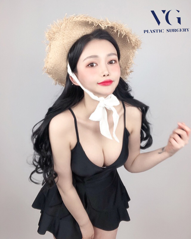 가슴재수술잘하는곳 성공적으로 마치기 위해서 관련 이미지 1