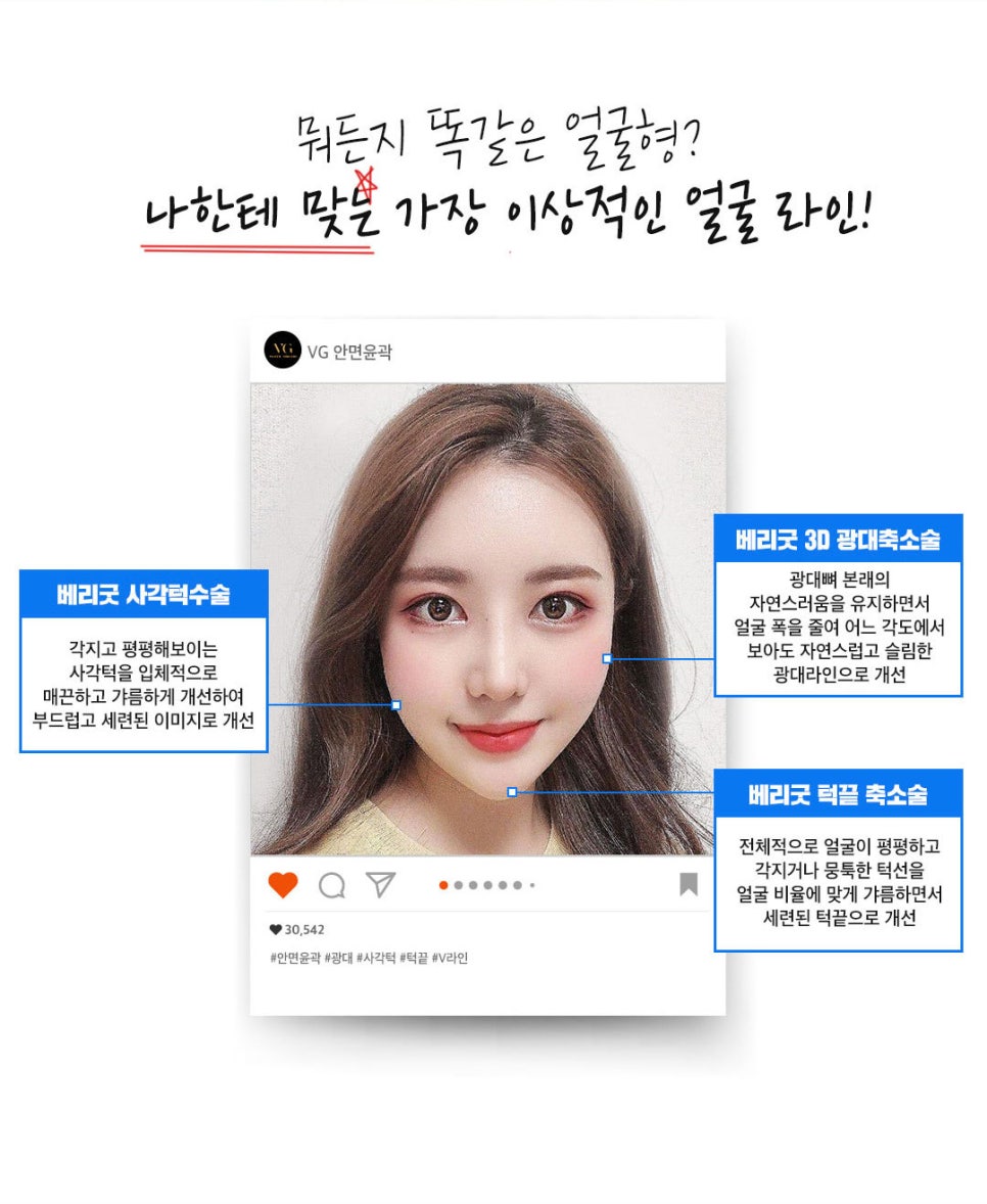 강남역광대축소 베리굿성형외과💜 관련 이미지 2