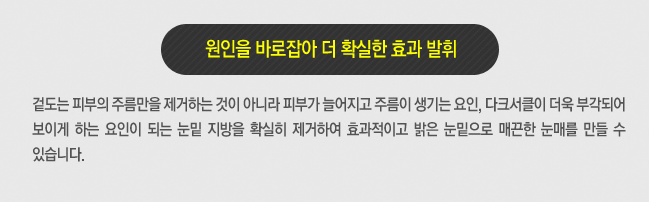 눈밑지방재배치 하고 환한 쌩얼로 자신있게! 관련 이미지 3