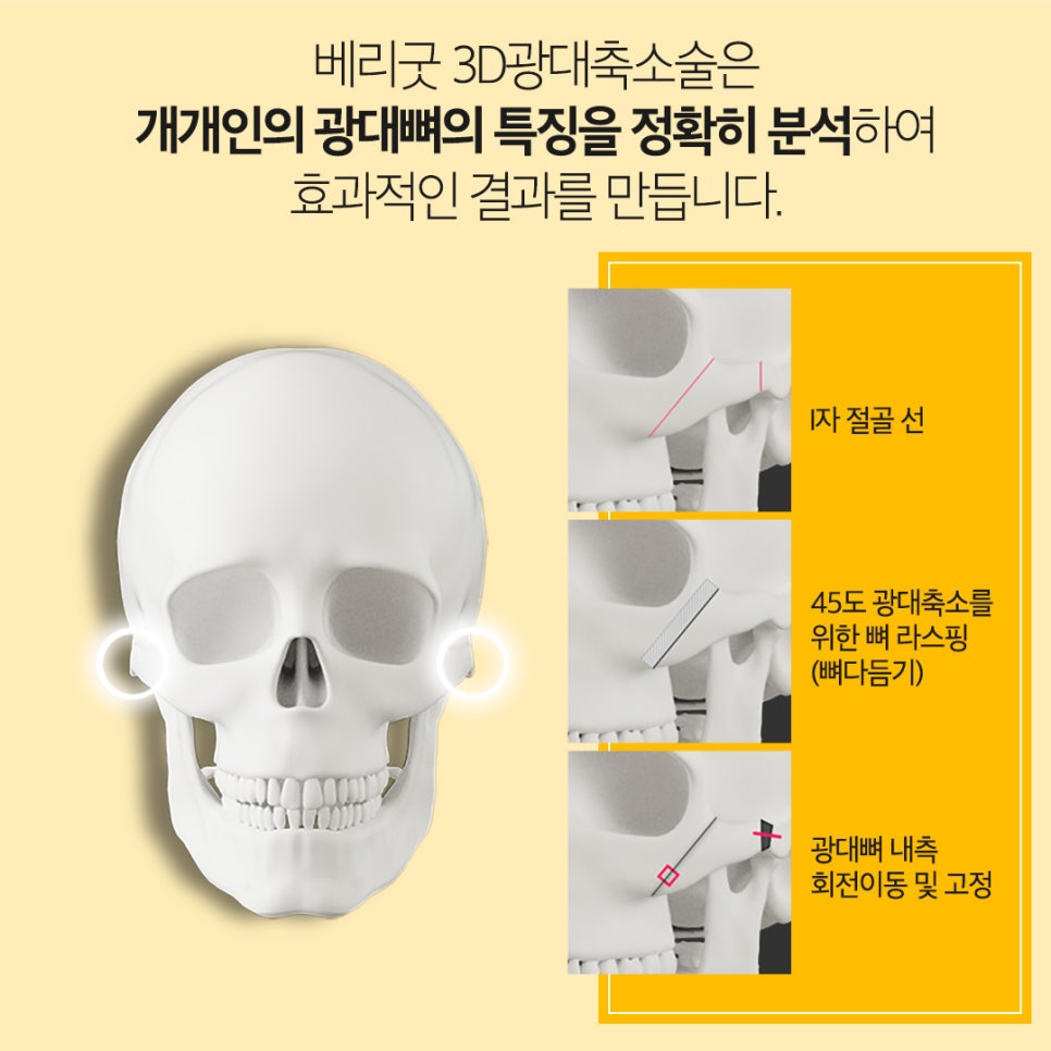 강남역 윤곽성형 베리굿성형외과👨&zwj;⚕️안면윤곽 전문의 임영민대표원장님💖 관련 이미지 5