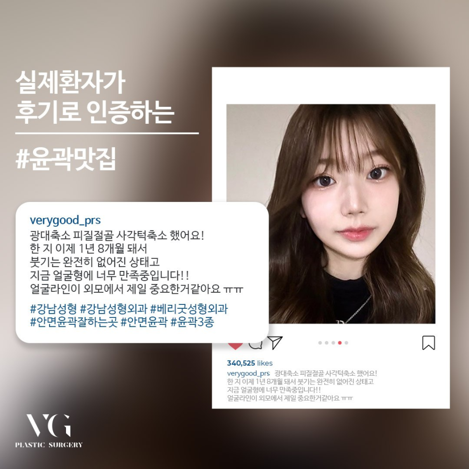 안면윤곽비용 , 비용만 생각해선 안돼 관련 이미지 12