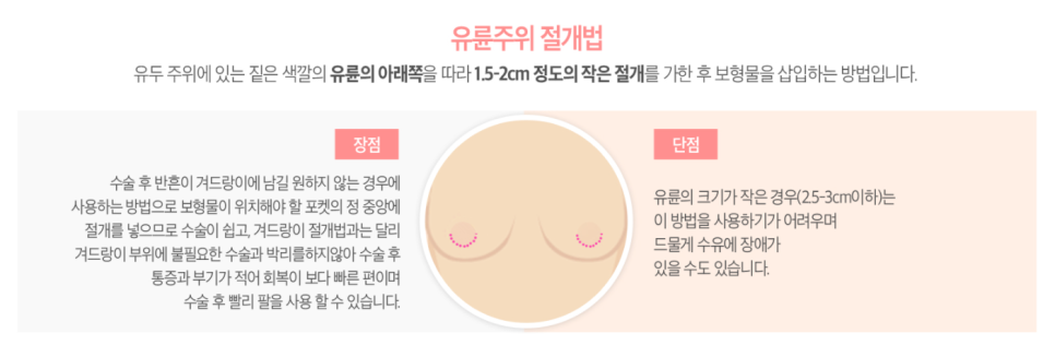 마른A컵도 가능🙈❤ 베리굿 성형외과의 베리굿 가슴성형✨ 관련 이미지 5