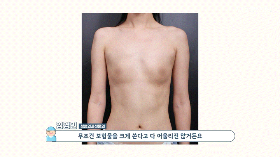 강남역가슴성형 절개법 절개부위 , 체형별 적합한 다양한 절개방법 장단점 총정리 관련 이미지 5
