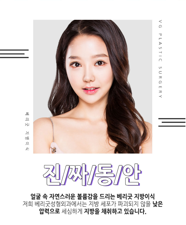 풀페이스지방이식, 베리굿성형외과에서 동안페이스로 거듭나자! 관련 이미지 4
